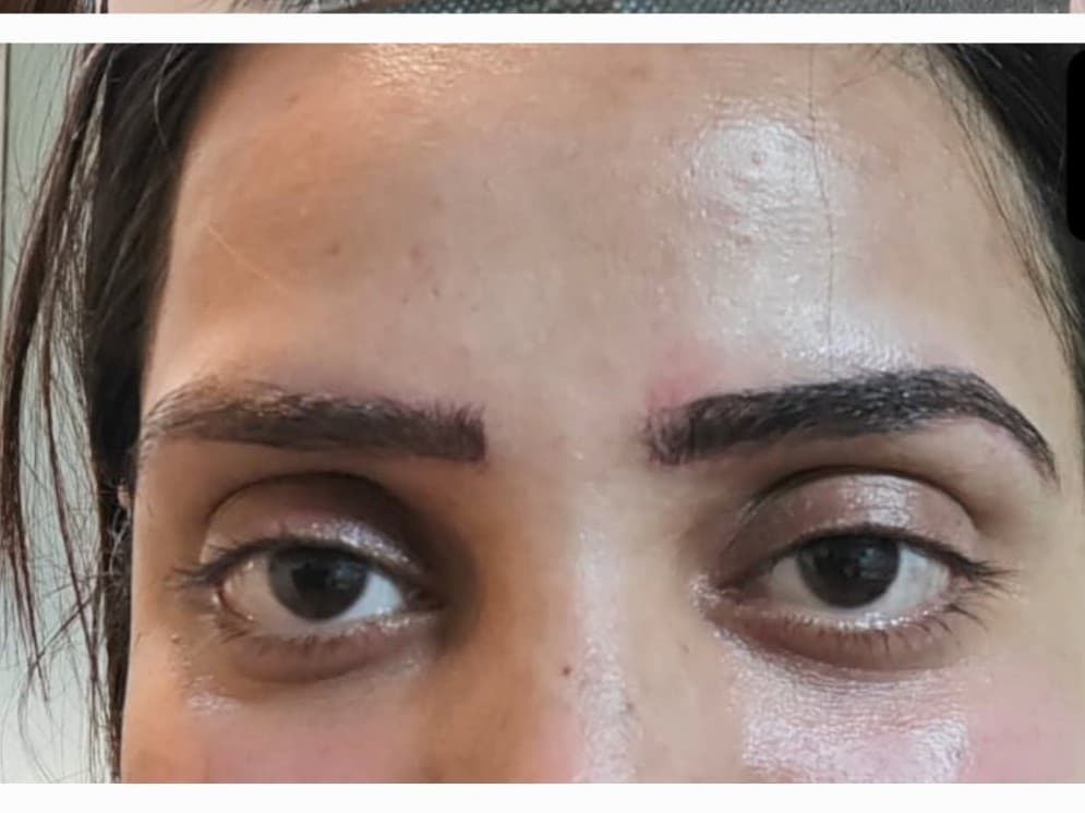 After Browfix