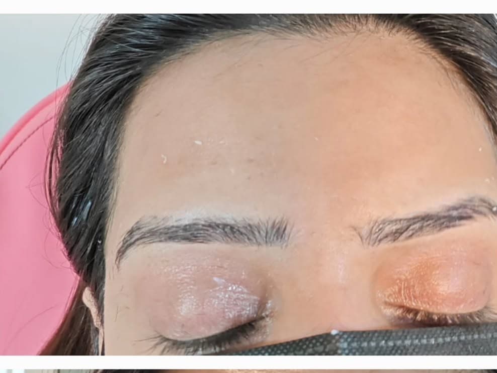 Before Browfix